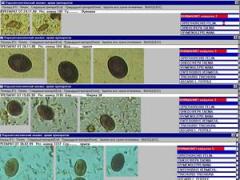 Фото 1 Пакет программ ПАРАЗ-ЦМ комплекса микроскопии МЕКОС-Ц2 для паразитологии 2014