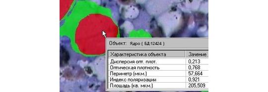 Фото 2 Программы МИКРО-ЦМ комплекса микроскопии МЕКОС-Ц2 для цитологии, гистологии 2014