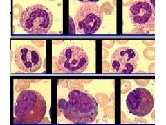 Фото 1 КЛИН1-ЦМ - пакет программ комплекса микроскопии МЕКОС-Ц2 для гематологии - АРМ врача-гематолога 2014