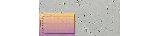 Фото 2 Программа МЕКОС-СПЕРМ для микроскопического анализа сперматозоидов 2014