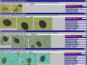 Пакет программ ПАРАЗ-ЦМ комплекса микроскопии МЕКОС-Ц2 для паразитологии