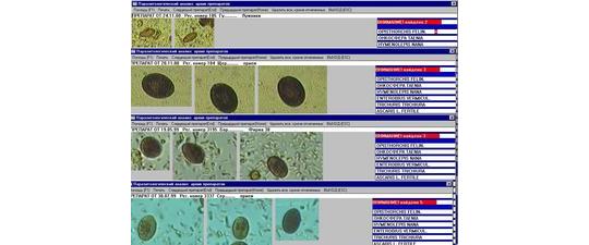 Фото 2 Пакет программ ПАРАЗ-ЦМ комплекса микроскопии МЕКОС-Ц2 для паразитологии 2014