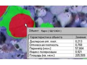 Программы МИКРО-ЦМ комплекса микроскопии МЕКОС-Ц2 для цитологии, гистологии