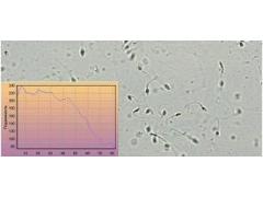 Фото 1 Программа МЕКОС-СПЕРМ для микроскопического анализа сперматозоидов 2014