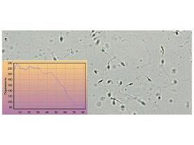 Программа МЕКОС-СПЕРМ для микроскопического анализа сперматозоидов
