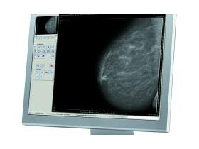 Маммограф МР цифровой