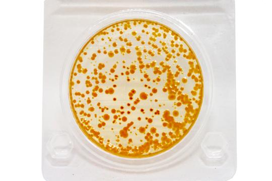 Фото 3 E.coli 2025