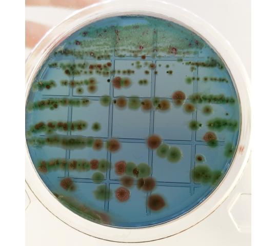 Фото 4 Shigella & Salmonella 2025