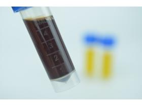 «Петритест®» на определение листерий